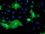 OSBP Antibody in Immunocytochemistry (ICC/IF)