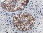 OSBP Antibody in Immunohistochemistry (Paraffin) (IHC (P))