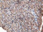 OSBP Antibody in Immunohistochemistry (Paraffin) (IHC (P))