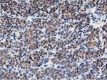 OSBP Antibody in Immunohistochemistry (Paraffin) (IHC (P))