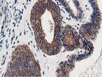 OSBP Antibody in Immunohistochemistry (Paraffin) (IHC (P))