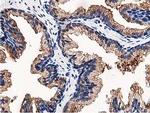 OSBP Antibody in Immunohistochemistry (Paraffin) (IHC (P))