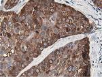 OSBP Antibody in Immunohistochemistry (Paraffin) (IHC (P))