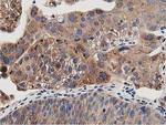 OSBP Antibody in Immunohistochemistry (Paraffin) (IHC (P))