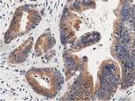 OSBP Antibody in Immunohistochemistry (Paraffin) (IHC (P))