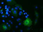 OSBPL11 Antibody in Immunocytochemistry (ICC/IF)