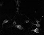 Pan RhO Antibody in Immunocytochemistry (ICC/IF)