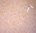 Cofilin 1 Antibody in Immunohistochemistry (Paraffin) (IHC (P))