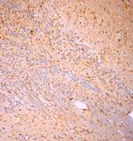 Cofilin 1 Antibody in Immunohistochemistry (Paraffin) (IHC (P))