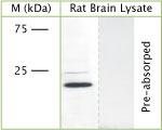 CAV1 Antibody in Western Blot (WB)