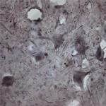 CACNA1I Antibody in Immunohistochemistry - Free Floating (IHC (Free))