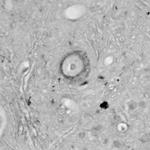 CACNA1I Antibody in Immunohistochemistry (Paraffin) (IHC (P))