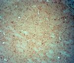 CACNA2D3 Antibody in Immunohistochemistry (Paraffin) (IHC (P))