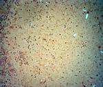 CACNA2D3 Antibody in Immunohistochemistry (Paraffin) (IHC (P))