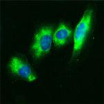 CD36 Antibody in Immunocytochemistry (ICC/IF)