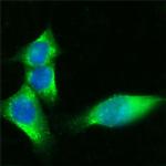 CD36 Antibody in Immunocytochemistry (ICC/IF)