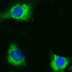 CD36 Antibody in Immunocytochemistry (ICC/IF)