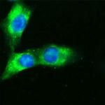 CD36 Antibody in Immunocytochemistry (ICC/IF)