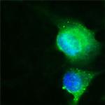 CD36 Antibody in Immunocytochemistry (ICC/IF)