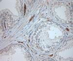 CLCN6 Antibody in Immunohistochemistry (Paraffin) (IHC (P))