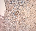 CLCN6 Antibody in Immunohistochemistry (Paraffin) (IHC (P))