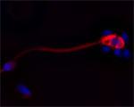 Cathelicidin Antibody in Immunocytochemistry (ICC/IF)