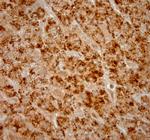 Catalase Antibody in Immunohistochemistry (Paraffin) (IHC (P))