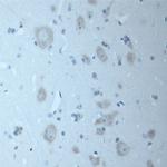 CNTNAP2 Antibody in Immunohistochemistry (Paraffin) (IHC (P))