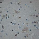 Cullin 5 Antibody in Immunohistochemistry (Paraffin) (IHC (P))