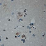 Cullin 5 Antibody in Immunohistochemistry (Paraffin) (IHC (P))