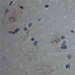 Cullin 5 Antibody in Immunohistochemistry (Paraffin) (IHC (P))