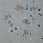 Cullin 5 Antibody in Immunohistochemistry (Paraffin) (IHC (P))