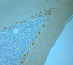 CALB1 Antibody in Immunohistochemistry (Paraffin) (IHC (P))