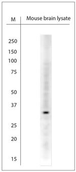 CALB1 Antibody in Western Blot (WB)