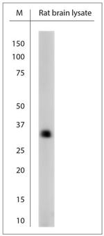 CALB2 Antibody in Western Blot (WB)