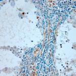 CD36 Antibody in Immunohistochemistry (Paraffin) (IHC (P))