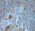 CD36 Antibody in Immunohistochemistry (Paraffin) (IHC (P))