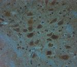 Clavesin 1 Antibody in Immunohistochemistry (Paraffin) (IHC (P))