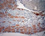 CACNA2D1 Antibody in Immunohistochemistry (Paraffin) (IHC (P))