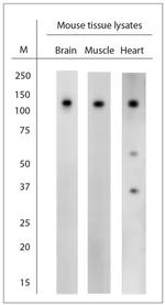 CACNA2D1 Antibody in Western Blot (WB)