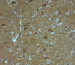 SAP97 Antibody in Immunohistochemistry (Paraffin) (IHC (P))