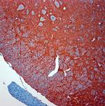 SLC1A2 Antibody in Immunohistochemistry (Paraffin) (IHC (P))