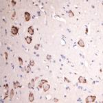 GLUR6 Antibody in Immunohistochemistry (Paraffin) (IHC (P))