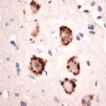 GLUR6 Antibody in Immunohistochemistry (Paraffin) (IHC (P))