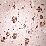 GLUR6 Antibody in Immunohistochemistry (Paraffin) (IHC (P))