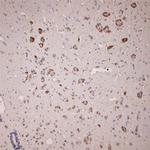 GLUR6 Antibody in Immunohistochemistry (Paraffin) (IHC (P))