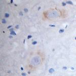 GRIK5 Antibody in Immunohistochemistry (Paraffin) (IHC (P))