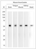 GABRA1 Antibody in Western Blot (WB)