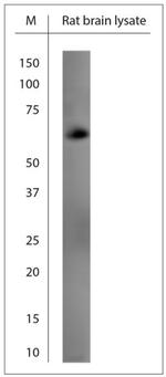 GAD65, 67 Antibody in Western Blot (WB)