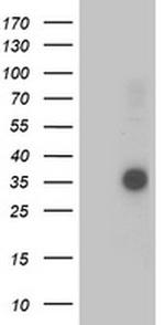 OSGEP Antibody in Western Blot (WB)